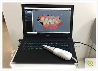 歯科用CT