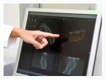 CTを用いた精密検査と治療計画の立案